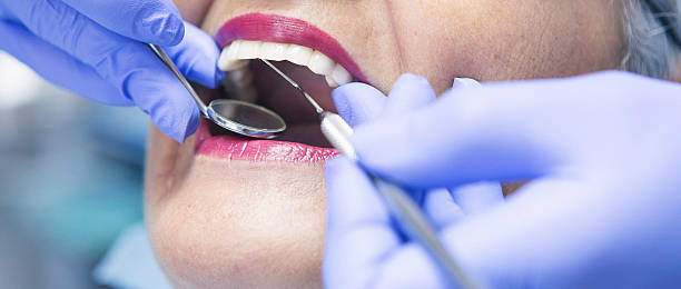 Best Emergency Dental Care for Broken or Chipped Teeth in Robesonia, PA